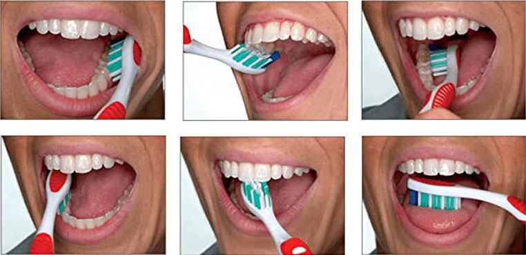 نحوه صحیح مسواک زدن