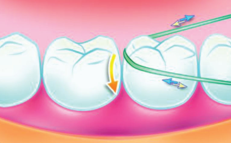 مراحل استفاده از نخ دندان