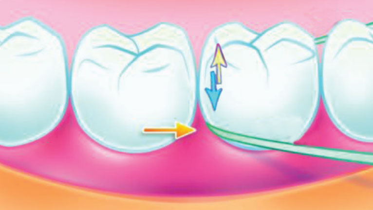 مراحل استفاده از نخ دندان
