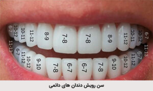 سن رویش دندان های دائمی